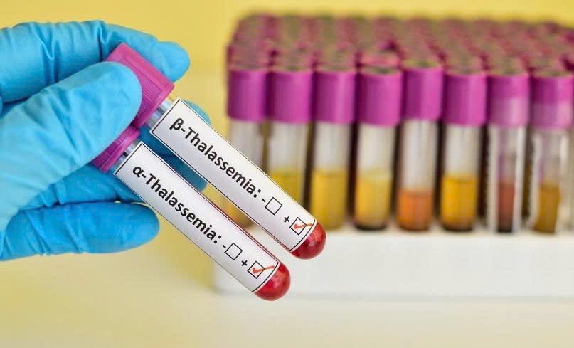 Tầm soát Thalassemia trước hôn nhân: Giải pháp chủ động phòng ngừa bệnh di truyền phổ biến